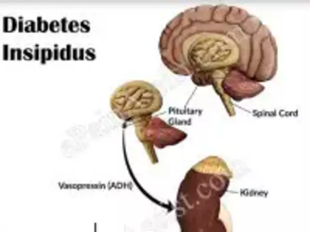 Desmopressin and Its Role in the Management of Post-Transplant Diabetes Insipidus