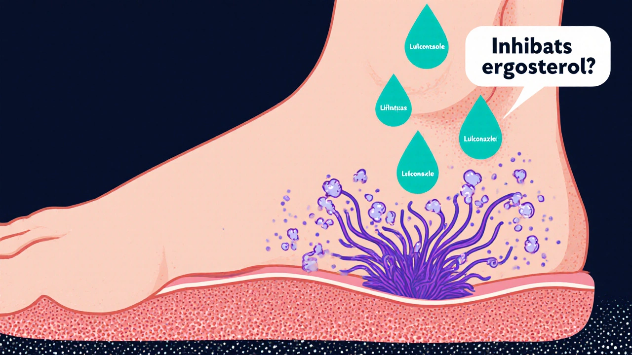 Cross‑section of foot skin showing Luliconazole droplets attacking fungal hyphae.